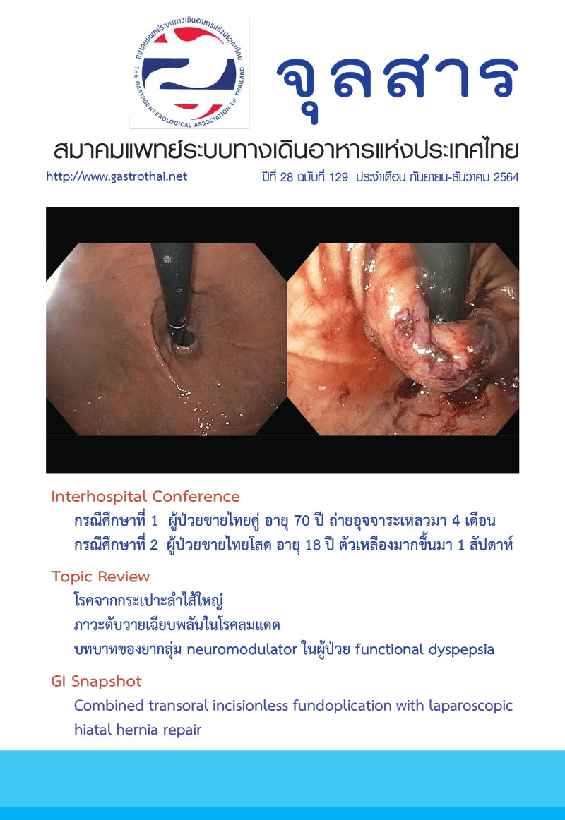 จุลสารสมาคมแพทย์ระบบทางเดินอาหารแห่งประเทศไทย ปีที่ 28 ฉบับที่ 129 กันยายน - ธันวาคม 2564