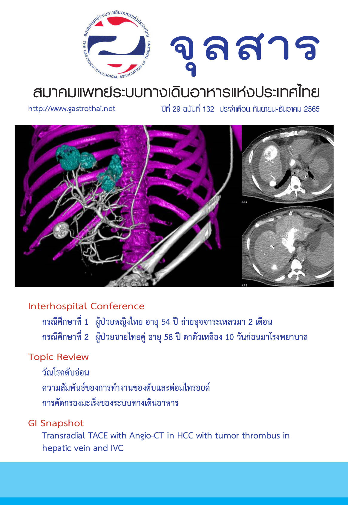 จุลสารสมาคมแพทย์ระบบทางเดินอาหารแห่งประเทศไทย ปีที่ 29 ฉบับที่ 132 กันยายน-ธันวาคม 2565